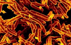 New treatment for tuberculosis: disease-causing bacteria will be starved