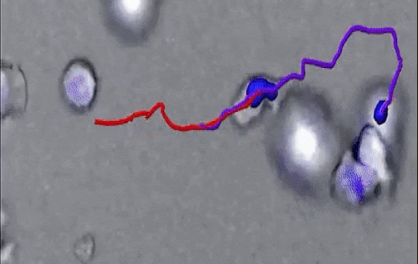 How immune components, make it through bodily tissues to get to the invasion?