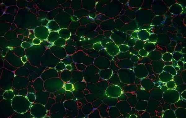 Blood vessel cells