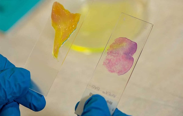 Yapay Zekâ Destekli Mikroskop