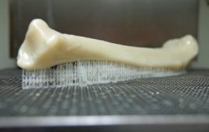 Yakında 3D Baskı ile Kemikler Doğrudan İnsan Vücuduna Yazdırılabilir