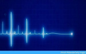 When is Dead Actually Dead? New Research Looks Into Life's Final Moments