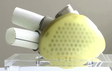 Kalp Donörü Bekleyenlere Alternatif: Yapay Kalp Cihazı Avrupa'dan Satış Onayı Aldı