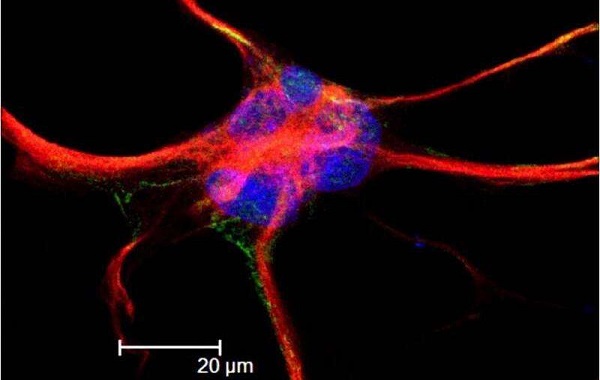 Star-shaped brain cells