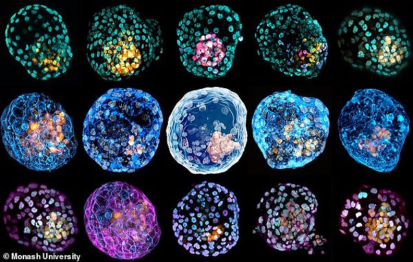 Devrim Yaratacak Çalışma Deri Hücrelerinden İnsan Embriyosu Kopyalıyor