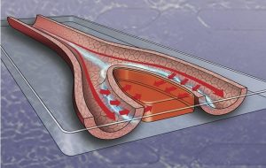 Yaralara Yeni Çözüm