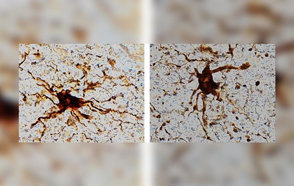 İnsan Beyninde Ölümden Sonra