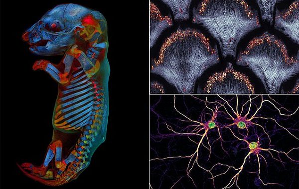Mikroskop Altında Çekilen Bilim Fotoğrafları Yarışmasının Kazananları Belli Oldu