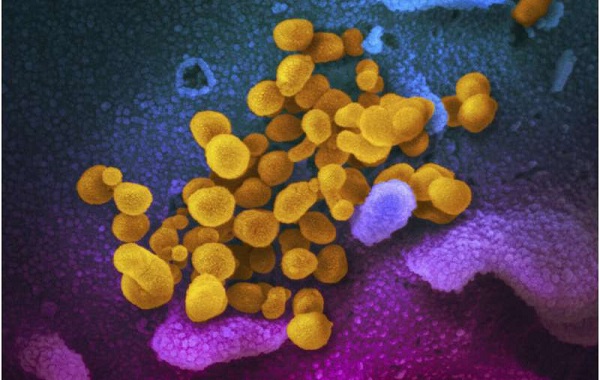 Most kids with serious inflammatory
