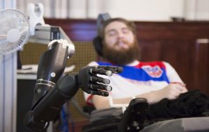 Beyin Çipi Takılan Felçli Adam Robotik El ile "Dokunma Hissi" Kazanan İlk İnsan Oldu