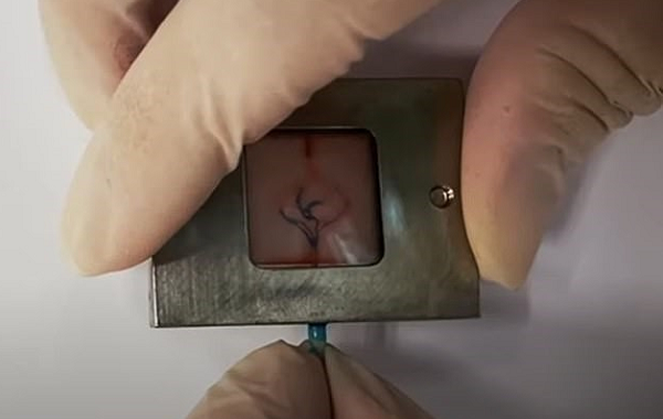 İlk Kez Bir Laboratuvarda 3D Baskı "Ölümcül Beyin Tümörü" Yapıldı