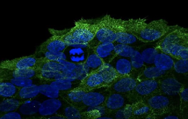 Discovery within cell cycle