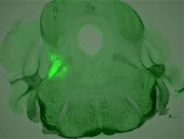 Scientists show how blocking