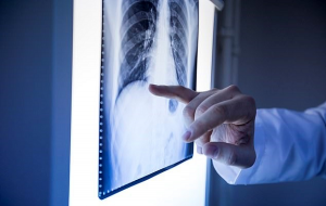 Yapay Zeka, Sadece Röntgenine Bakıp Kişinin Irkını % 99'a Varan Doğrulukla Tahmin Edebilir