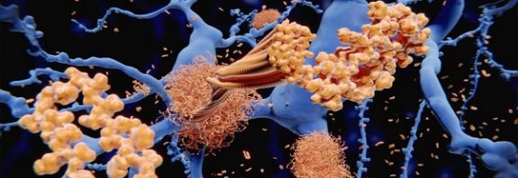 Alzheimer’s Mystery Solved: How Amyloid Beta Forms in Brain Nerve Cells