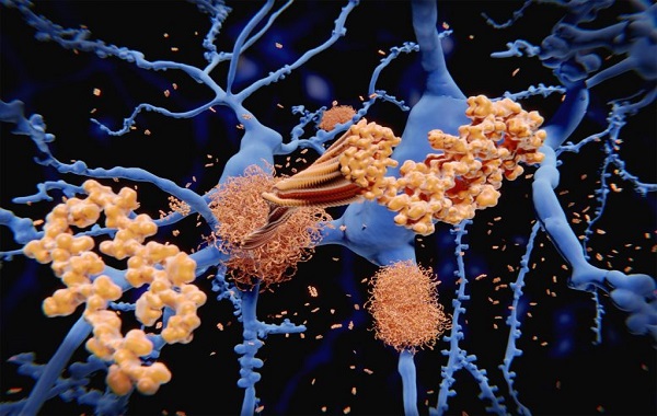 Alzheimer’s Mystery Solved: How Amyloid Beta Forms in Brain Nerve Cells