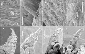 Baby Octopuses Grow Hundreds of Mystery Organs Only to Lose Them as They Grow Up