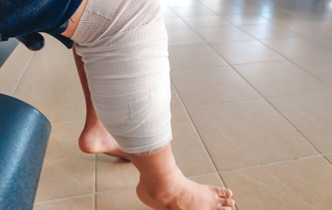 Yarayı Açmadan İyileşmeyi Gösteren Akıllı Bandaj Üretildi