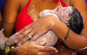 Baby In Brazil Born With 12-Centimeter-Long "True" Human Tail