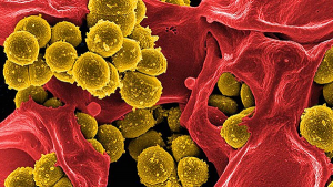 Enfeksiyonla Mücadelede Altın, Beklenmedik Bir Gizli Silah Olabilir