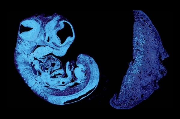 Cinsiyetler Savaşının Anne Karnında Başladığı Ortaya Çıktı
