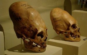 DNA Tests Reveal That Paracas Skulls Are Not Human