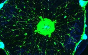 Bilim İnsanları Beyni Olmayan