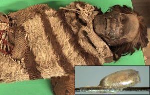 İlk Defa Baş Biti Kullanılarak, Antik Bir Mumyanın DNA'sı Çıkarıldı