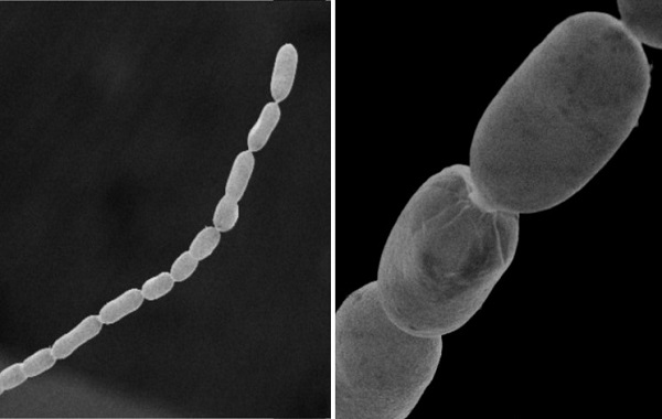 Biggest bacterium ever discovered amazes scientists with its complexity