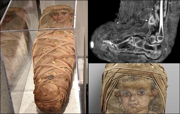 Ahirette İyileşsin Diye Çocuk Mumyaya Yapılan Uygulama Geçmişe Işık Tuttu