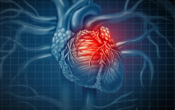 Deleting a Protein May Prevent Heart Attacks and Strokes