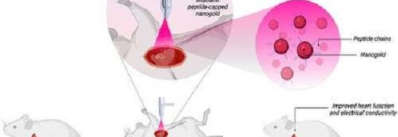Spray of tiny particles of gold can potentially treat heart disease, research suggests