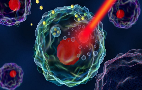 A new tool against cancer: Laser and nanoscale materials
