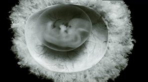 İnsan Genomunda 106 Milyon Yıllık 'Fosilleşmiş' Virüs Bulundu