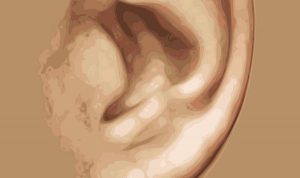 İşitme Kaybını Tersine Çeviren Bir Tedavi Geliştirildi
