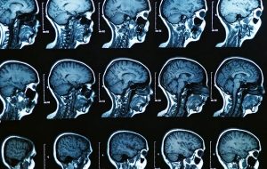 İlk Kez İnsan Beyninin Doğumdan Ölüme Kadar Nasıl Değiştiği İzlendi