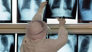 Yapay Zekanın Röntgenden Irk Tahmini Yapabilmesi Doktorları Endişelendirdi