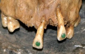 Fancy Ancient Maya Tooth Jewelry May Have Helped Ward Off Oral Infections Too