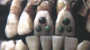 Antik Mayalar Dişlerine Değerli Taşlarla Dolgu Yapıyorlardı