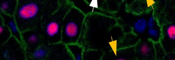 Surprise! Your liver is just 3 years old, whether you're 20 or 84
