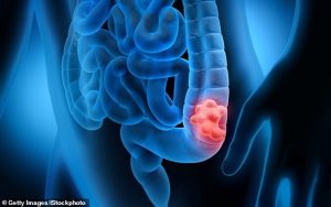 Kanser Tarihinde Bir İlk Yaşandı: Deneysel Tedavide Hastaların Tamamı İyileşti