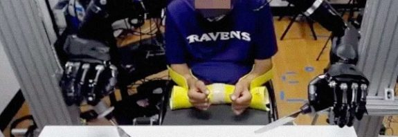 Zihin Kontrollü Robotik Kollarıyla, Felçli Bir Adam 30 Yıl Sonra Yeniden Yemek Yedi