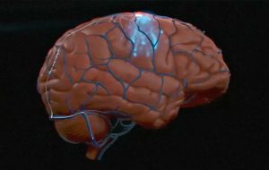 Synchron says it's the first to implant a human brain-computer interface in the US