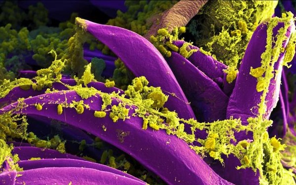 Scientists Say Extinct Pathogens Ushered The Fall of Ancient Civilizations