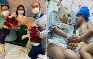 Yapışık İkizler Sanal