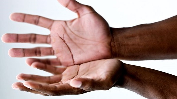 Siyahi İnsanların Avuç İçleri ve Ayak Tabanları Neden Beyazdır?