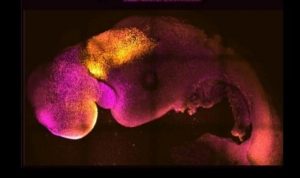 Beyni Ve Atan Kalbi Bulunan ‘Yapay’ Embriyo