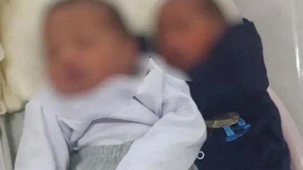 Tıp Dünyası Şaşkın: Aynı Gün İki Erkekle İlişkiye Girdi İkiz Doğurdu