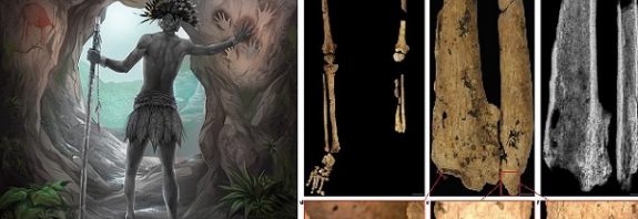 31.000 Yıl Önce Sol Ayağı Cerrahi Olarak Kesilmiş Bir Gencin Kalıntıları Bulundu