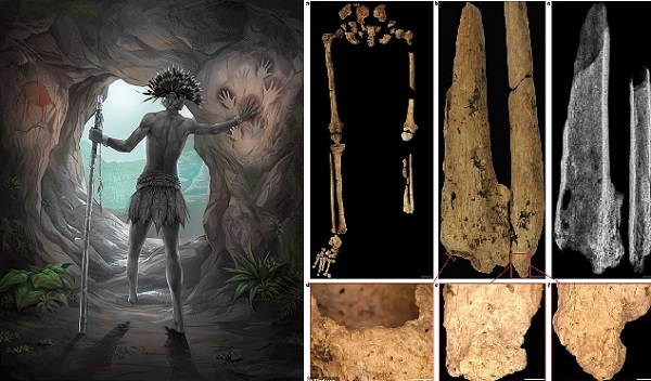 31.000 Yıl Önce Sol Ayağı Cerrahi Olarak Kesilmiş Bir Gencin Kalıntıları Bulundu